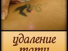 Скачать бесплатно фотографию  Удаление татунекачественного тату и татуажа 59058087 в Новосибирске